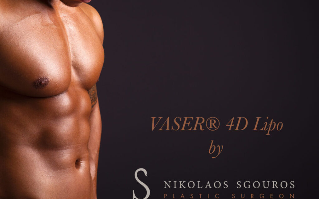 VASER 4D λιποαναρρόφηση
