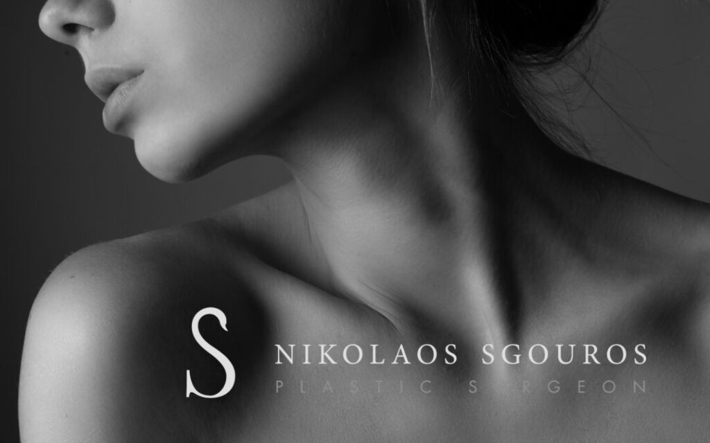 VASER λιποαναρρόφηση λαιμού- Ανάρρωση