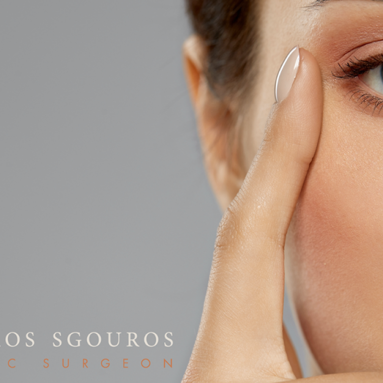 Bλεφαροπλαστική άνω βλεφάρου