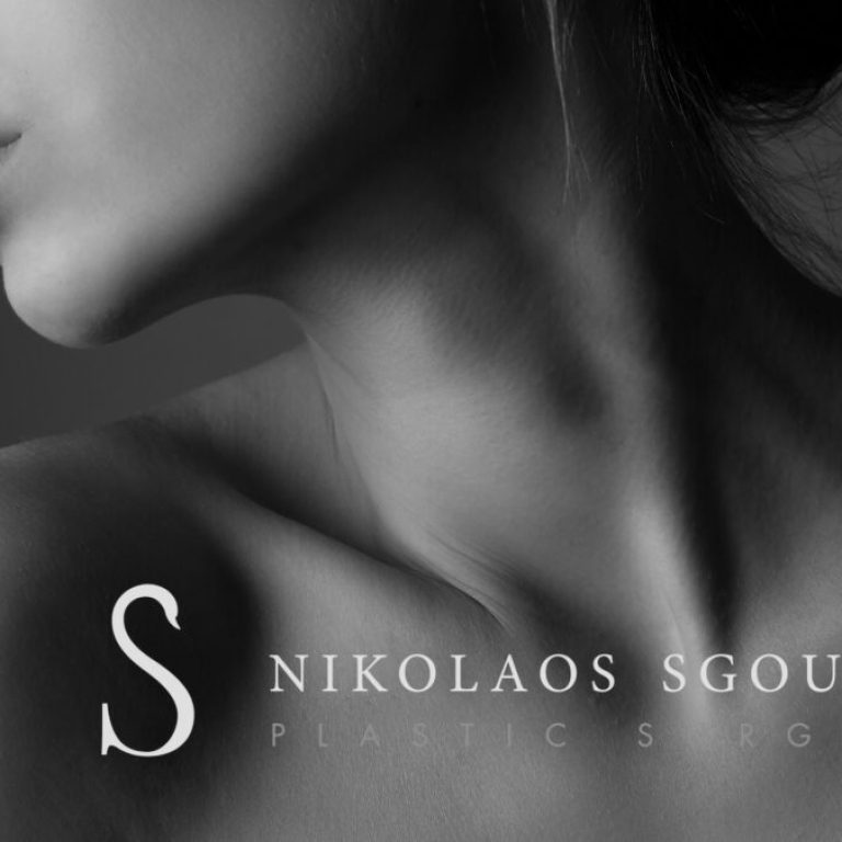 VASER λιποαναρρόφηση λαιμού- Ανάρρωση