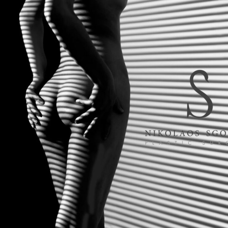 Αυξητική γλουτών με λίπος ή υαλουρονικό οξύ;